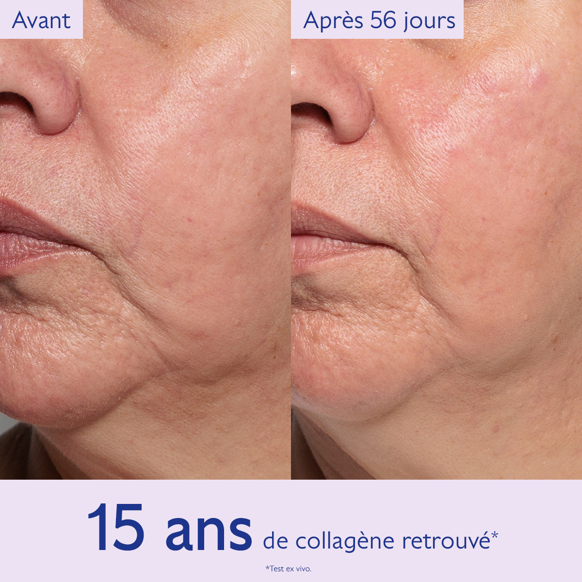 resveratrol-lift