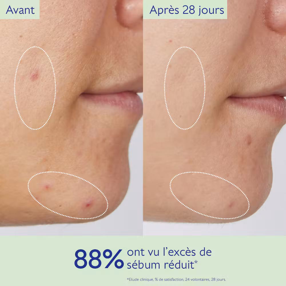 Gelée Nettoyante à l'Acide Salicylique Purifiante - 75mL
