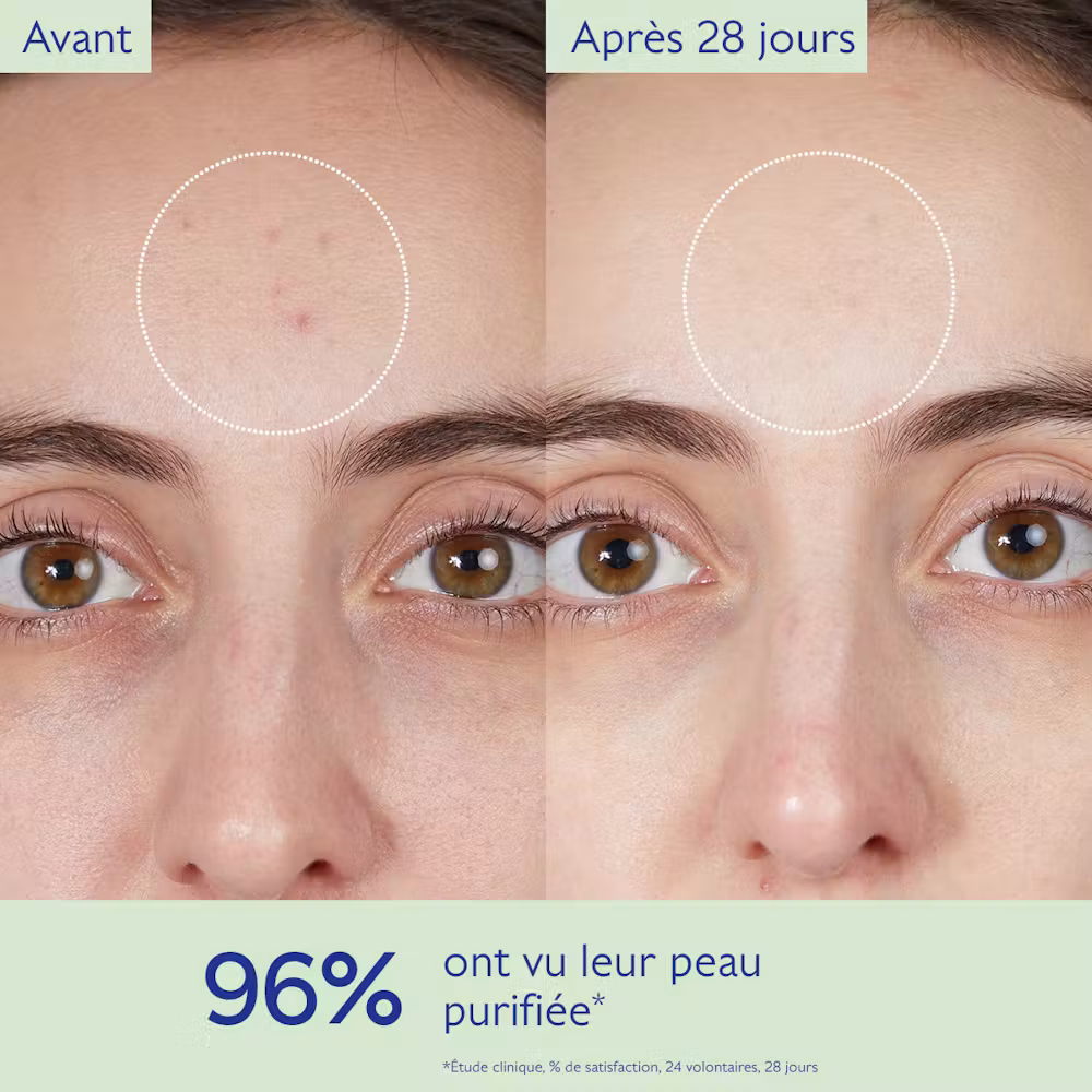 Gelée Nettoyante à l'Acide Salicylique Purifiante