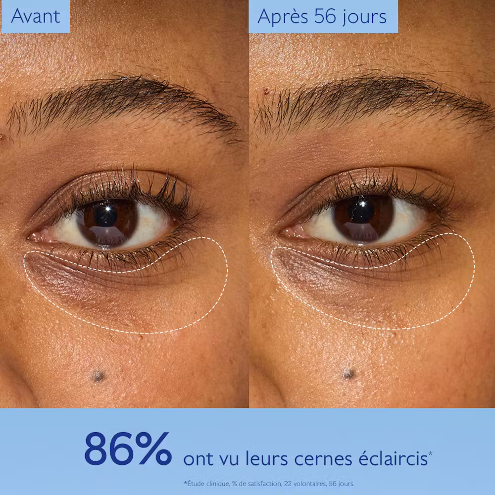 Soin Éclaircissant Regard Anti-Cernes à la Caféine et Niacinamide