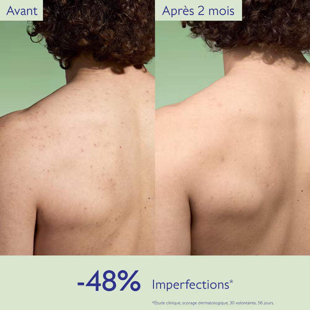 Lotion Purifiante à l'Acide Salicylique