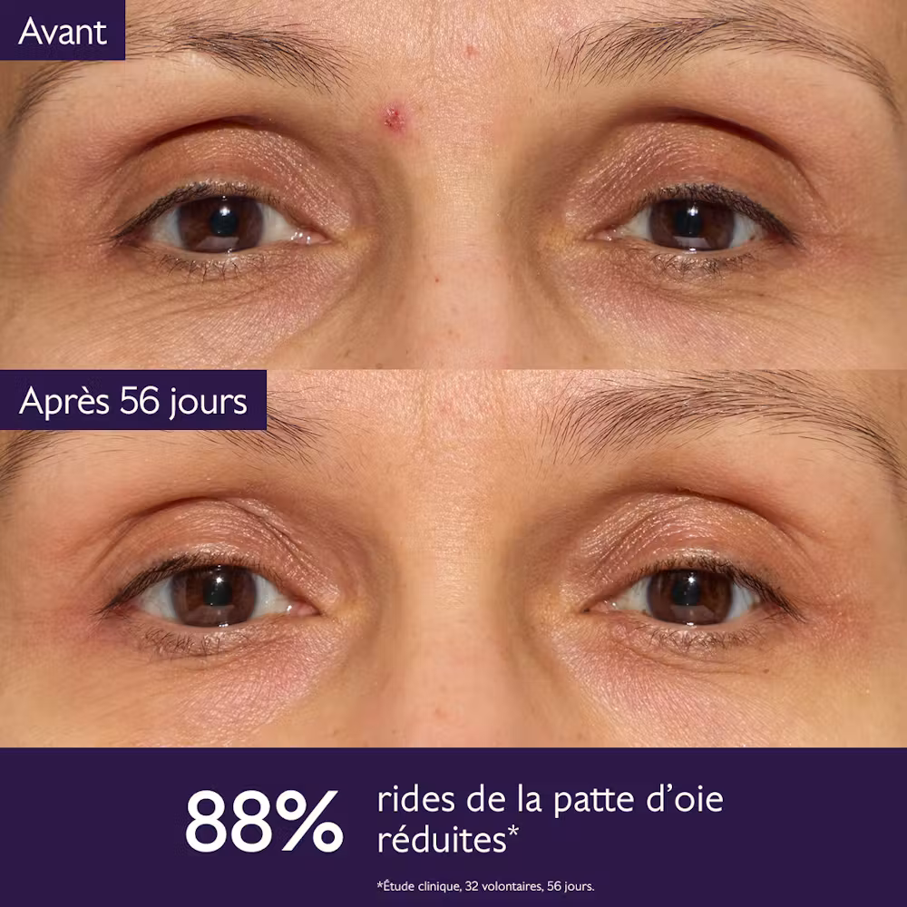 La Solution Anti-Âge Global