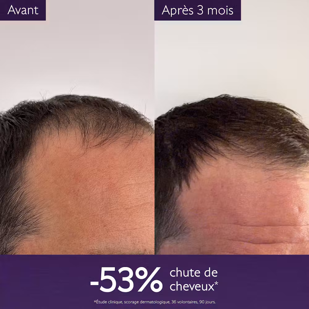 Sérum Capillaire Anti-chute