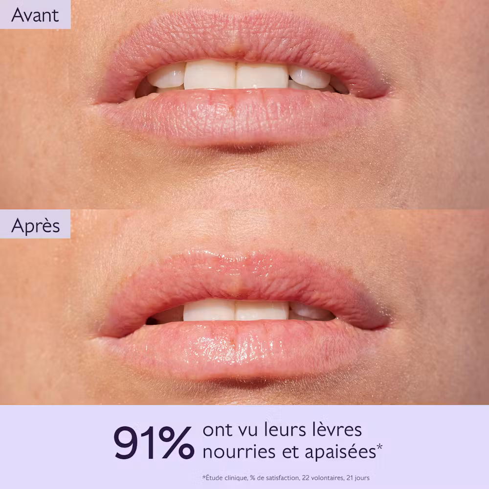 Soin des Lèvres au Beurre de Karité
