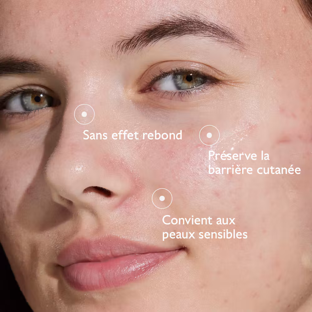 Sérum à l'Acide Salicylique Anti-imperfections