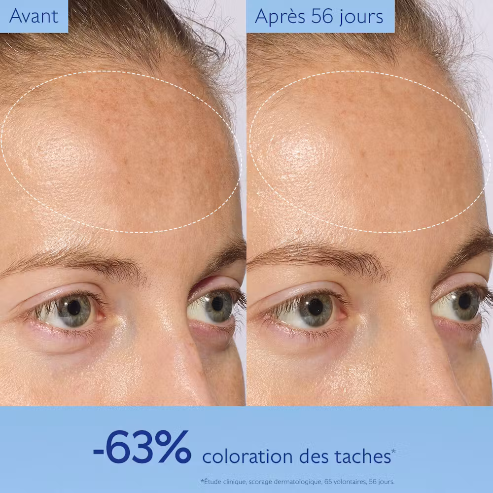 Photo avant-après 56 jours d'utilisation du Sérum Vinoperfect Caudalie : -63% de coloration des taches, résultats sans retouche